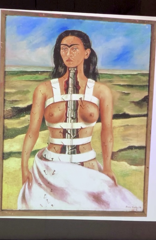 Immagine opera colonna spezzata di Frida Kahlo
